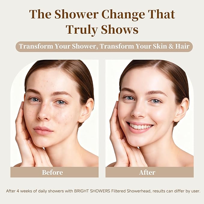 BRIGHT SHOWERS Filtered Shower Head, High Pressure Shower Filter for Hard Water to Remove Chlorine and Impurities, 8 Spray Modes Water Softener Showerhead for Hair and Skin Care, Oil Rubbed Bronze