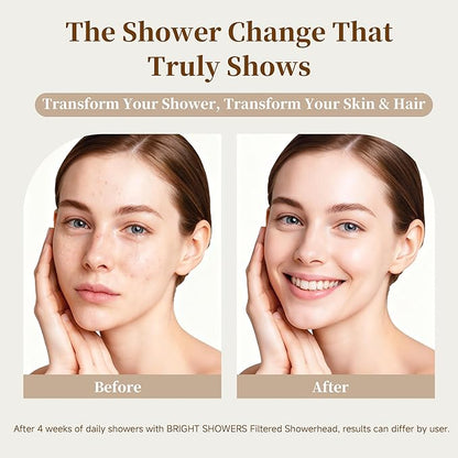 BRIGHT SHOWERS Filtered Shower Head, High Pressure Shower Filter for Hard Water to Remove Chlorine and Impurities, 8 Spray Modes Water Softener Showerhead for Hair and Skin Care, Oil Rubbed Bronze